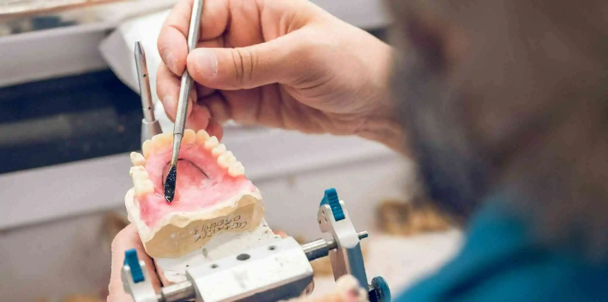 Dentakey: A Practical Dental Supplier in London